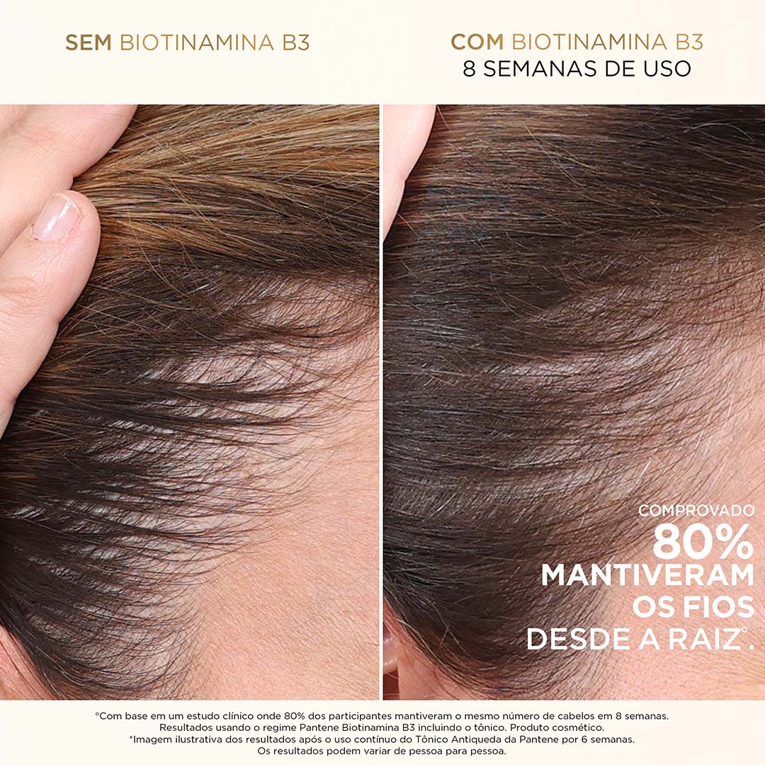 Imagem do produto: Creme para pentear Antiqueda com Biotinamina B3
