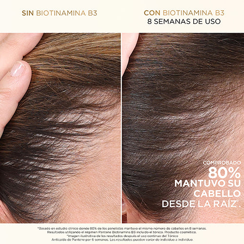 Imagen de producto: Shampoo anticaída+  con Biotinamina B3