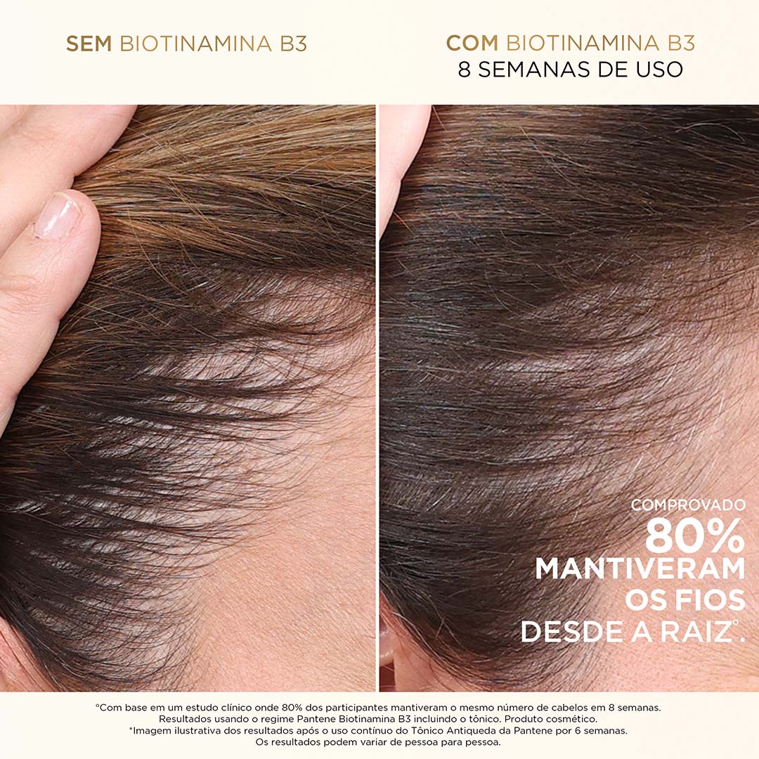 Imagem do produto: Shampoo antiqueda⁺ com Biotinamina B3